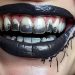 Quels sont les dangers du dentifrice au charbon pour vos dents