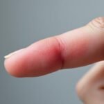 Douleur au doigt sans raison apparente : causes et solutions